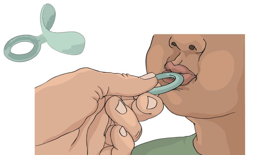 På bilden syns en person som tränar med en munskärm. Själva hjälpmedlet munskärm är också med på bilden som en illustration.