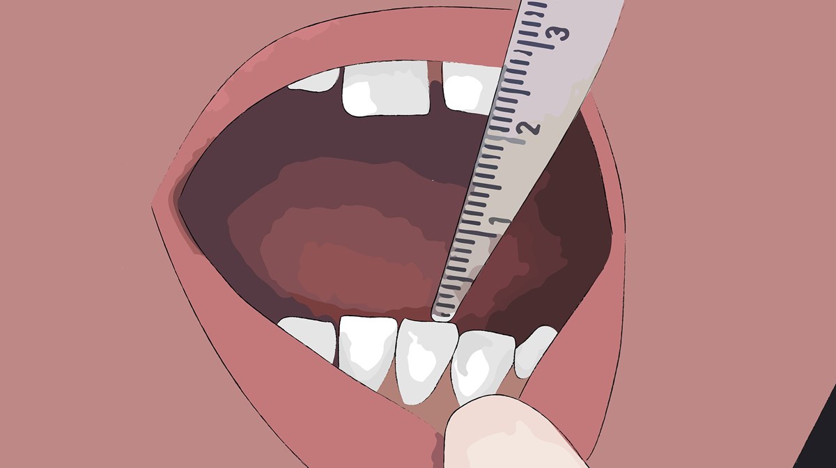 En mun som gapar och ett linjal som mäter hur mycket munnen går att öppna. 