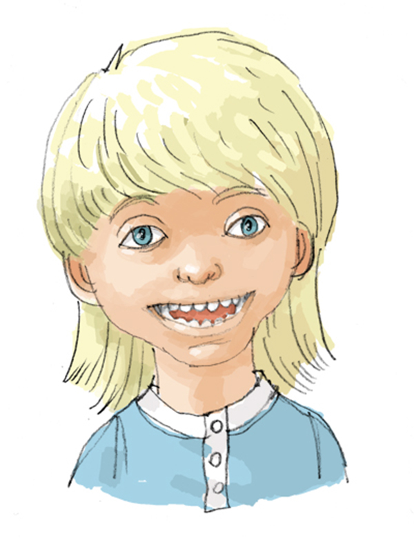 Angelman syndrome - Public_munhcenter